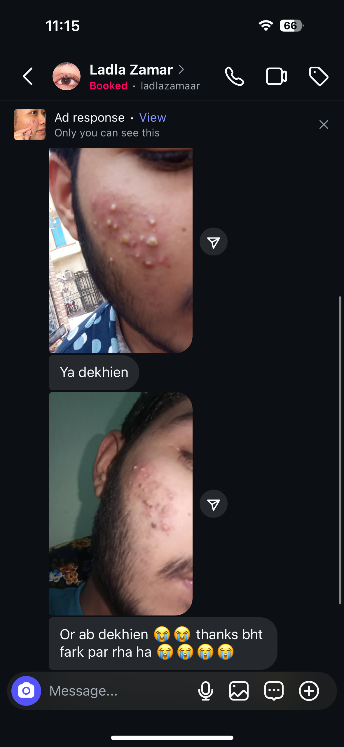 Anti Acne & Glowing Serum | Salicylic 2%, Vitamin C & E and Tea Tree Extract 2%