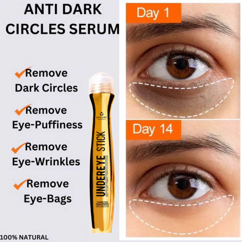 Under Eye Dark Circle Serum | Opulent Body