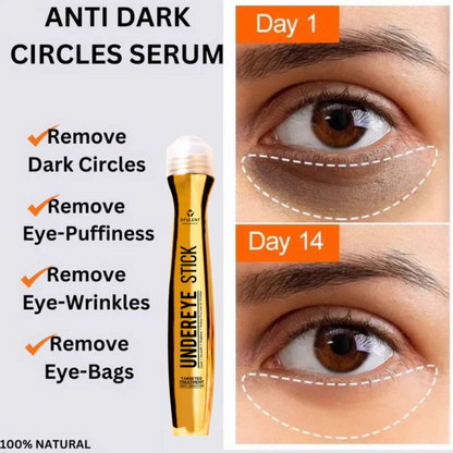 Under Eye Dark Circle Serum | Opulent Body