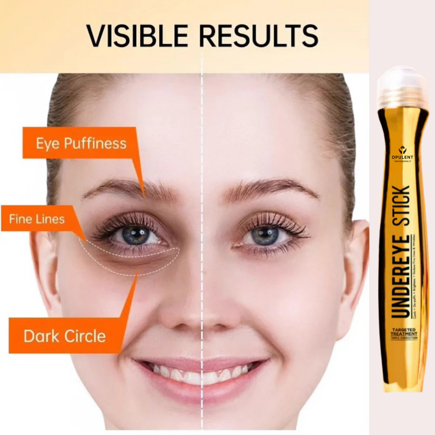 Under Eye Dark Circle Serum | Opulent Body