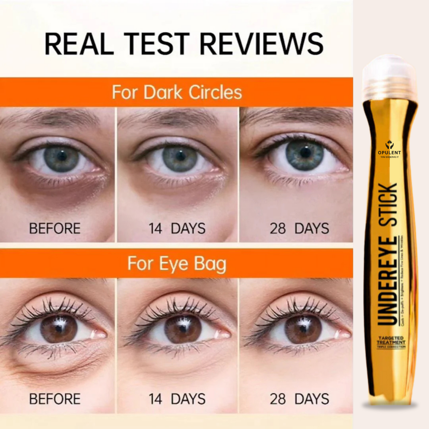 Under Eye Dark Circle Serum | Opulent Body