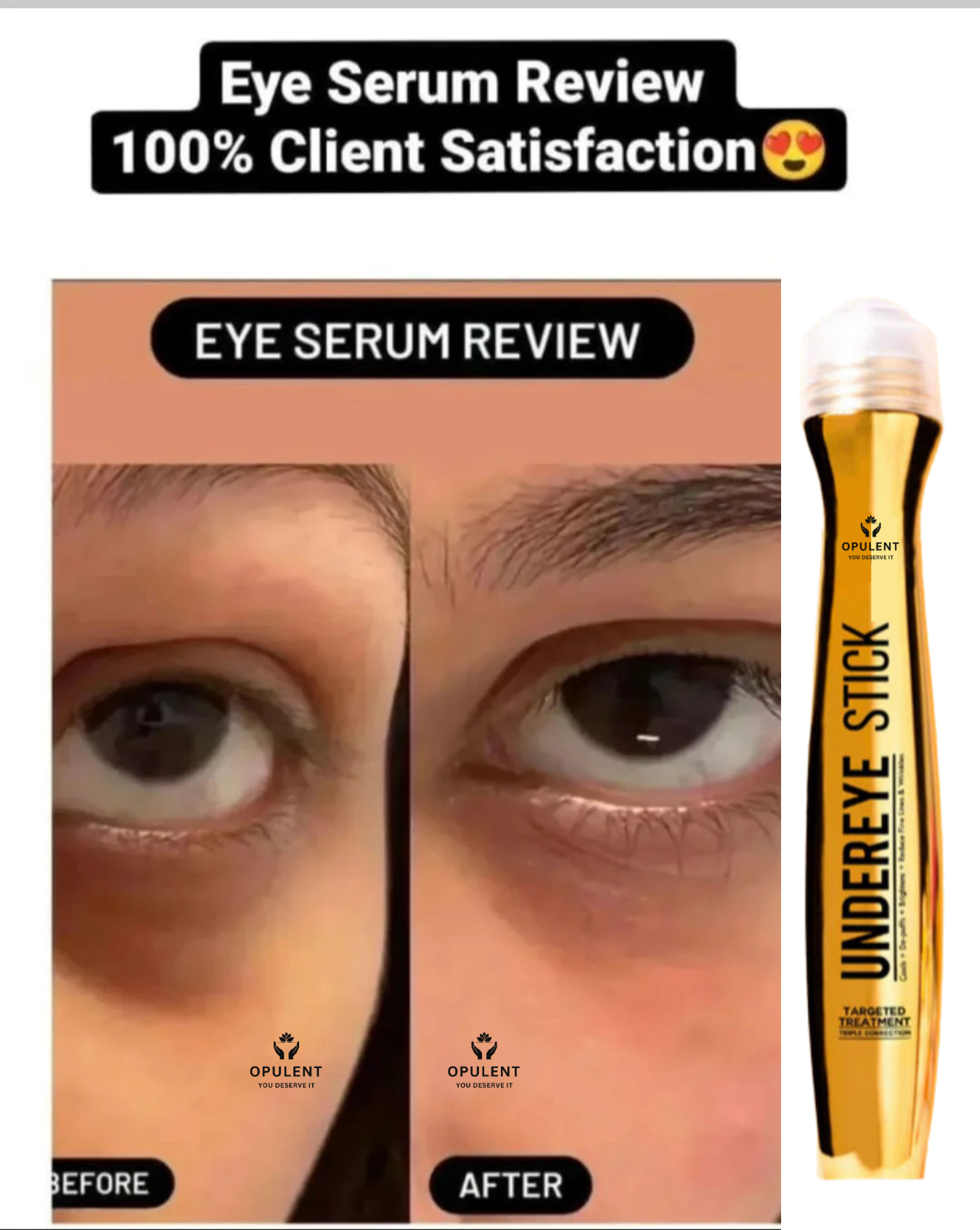 Under Eye Dark Circle Serum | Opulent Body