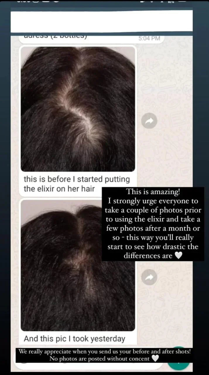 Anti Hair Fall & Re Growth Hair Oil | Active Rosemary & Blend of 7 Oils | Opulent Body